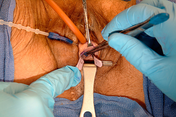 Implant Procedure